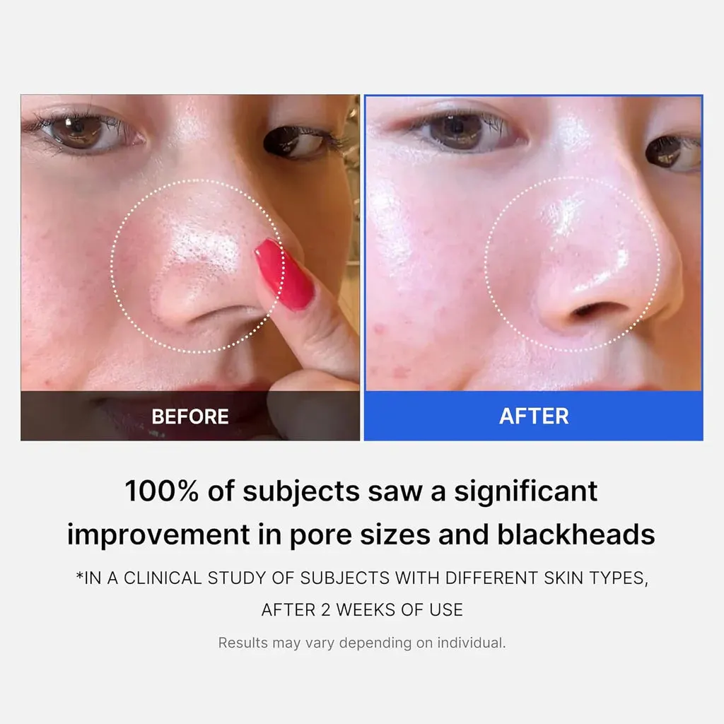 Medicube Zero Pore Pad (70)