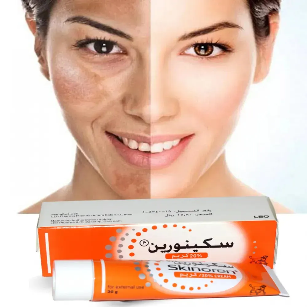 Skinoren Azelaic Acid 20%